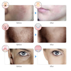 Photon Glow Mask
