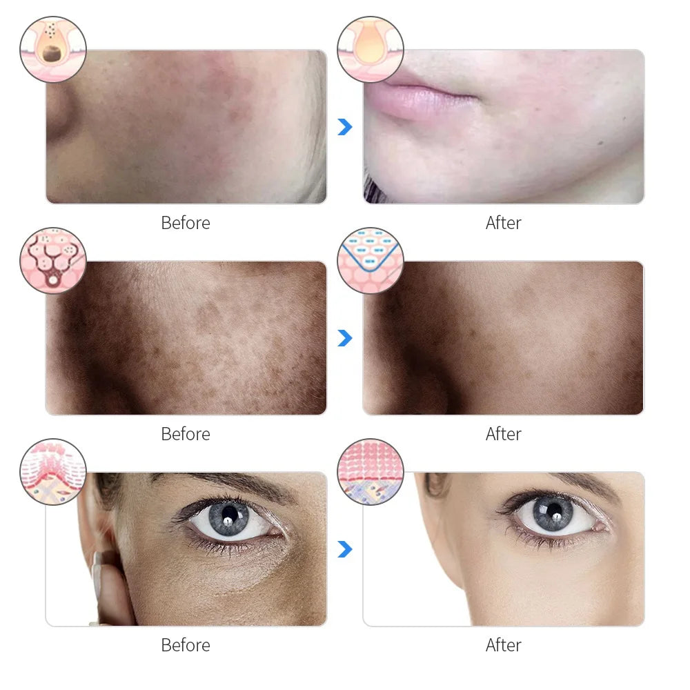 Photon Glow Mask